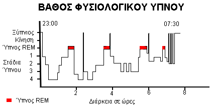 ypnos-01