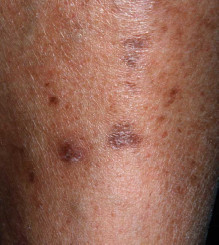 diav.dermatopathia