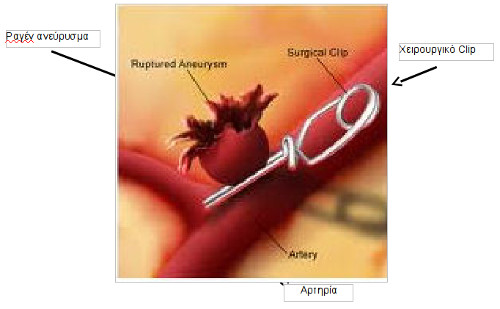 vlaves-aggeion-egkefalou-03