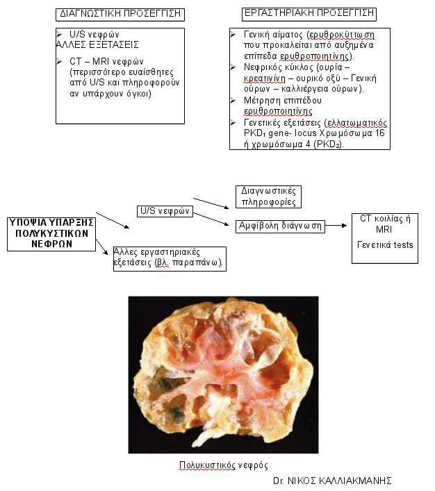 polikistikos_nefros