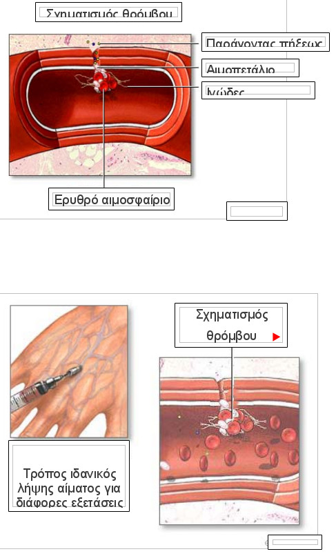 thromvos